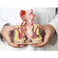 Prierezový model konečníka, hemeroidy (zväčšený) s patológiami