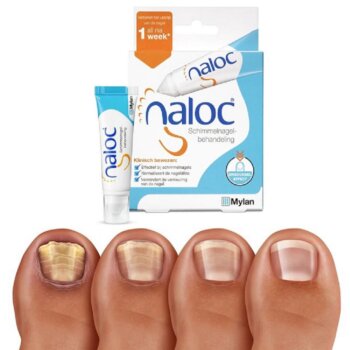 Intenzívna lokálna starostlivosť pri nechtovej mykóze a psoriáze NALOC, 10ml