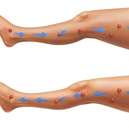 Presoterapia – lymfodrenážny masážny prístroj na nohy (domáce použitie) - Náhľad