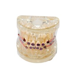 Model chrupu, zubných implantátov so zubným strojčekom, transparentný