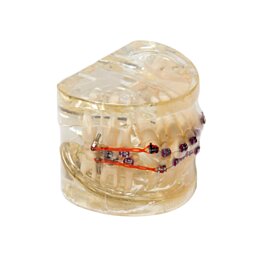 Model chrupu, zubných implantátov so zubným strojčekom, transparentný - Náhľad