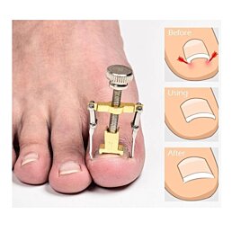 Proti zarastaniu nechtov na nohách