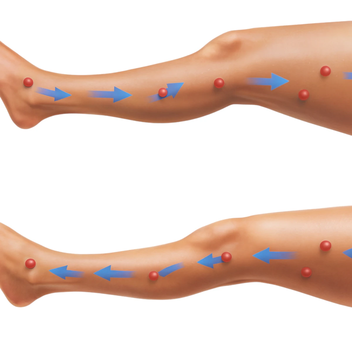 Lymfodrenážny prístroj – použitie na stehná a lýtka