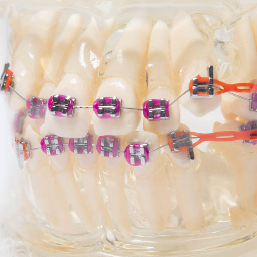 Model zubných implantátov 1