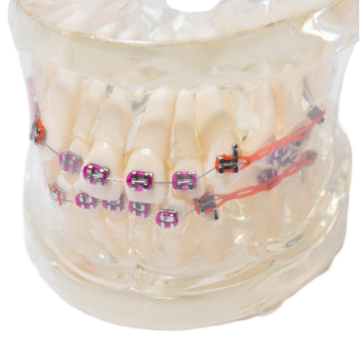 Model zubných implantátov 2