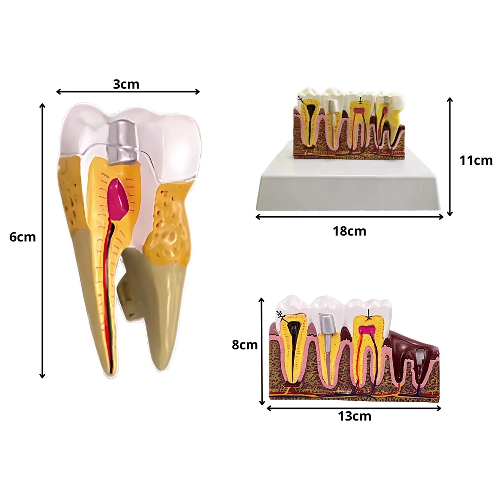 Priečny rez zuba – edukatívny model pre výučbu zubných ochorení