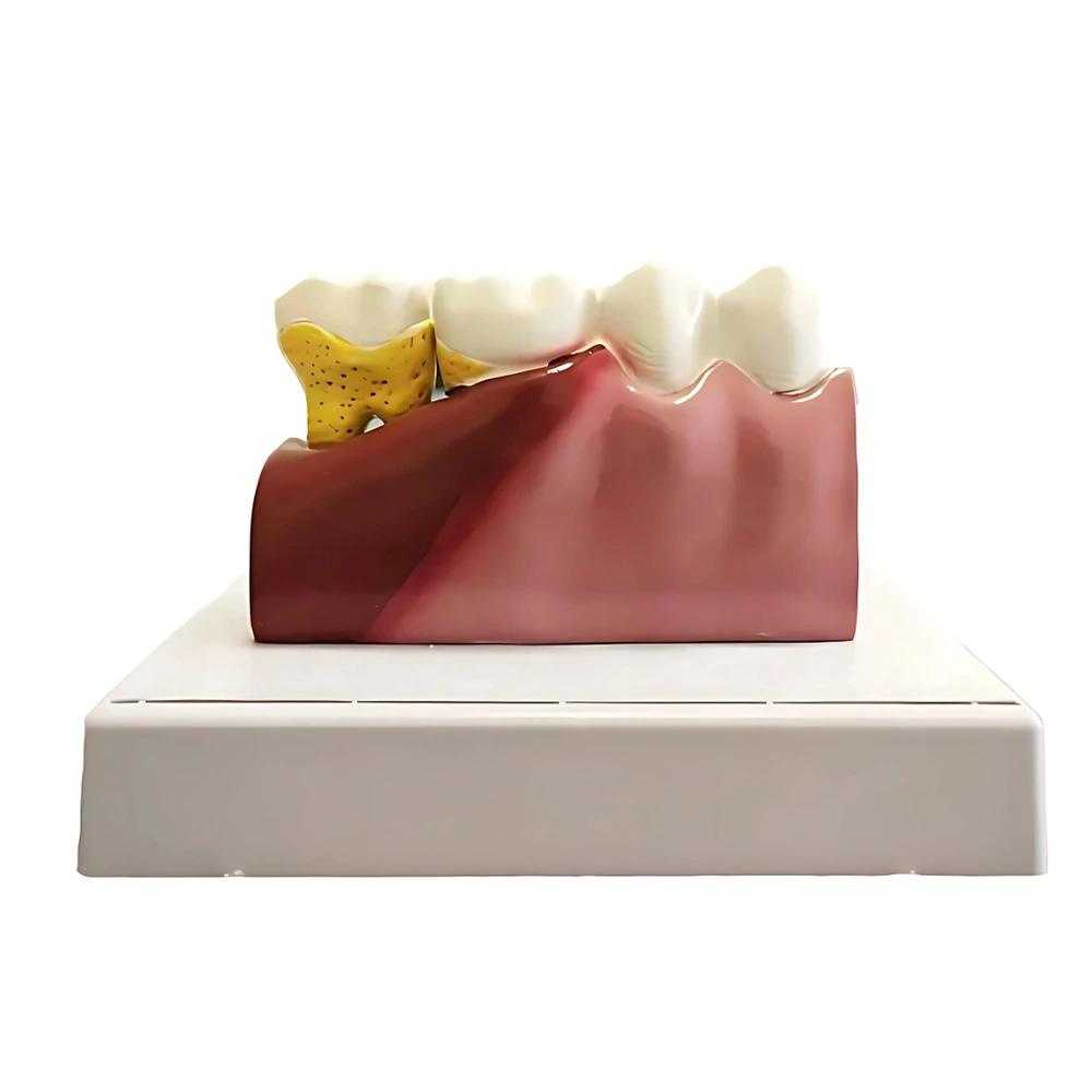 Model zuba s vyberateľnou časťou pre edukačné účely