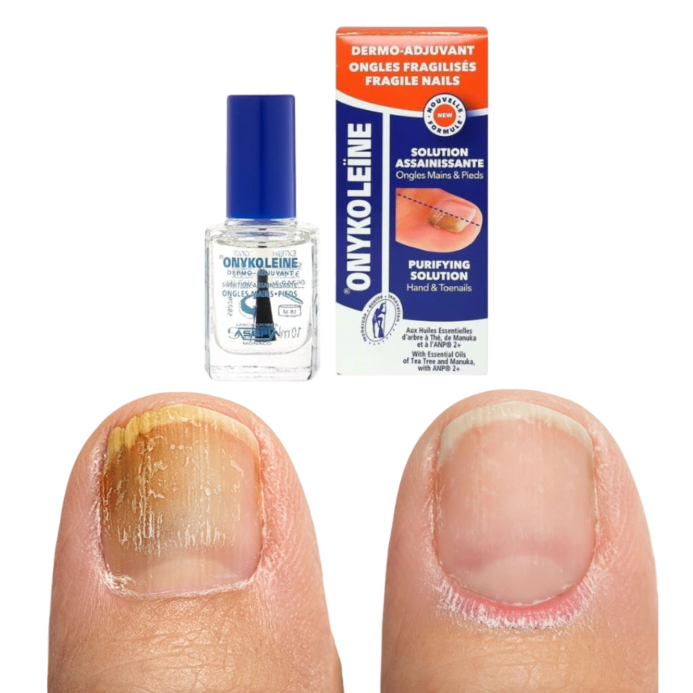 Onykoleine roztok na oslabené nechty 10 ml