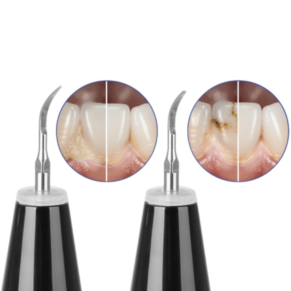 Nadstavce a príslušenstvo k ultrazvukovému čističu zubného kameňa