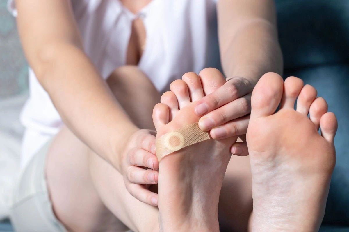 Žena si lepí ochrannú náplasť na bradavicu na chodidle. 