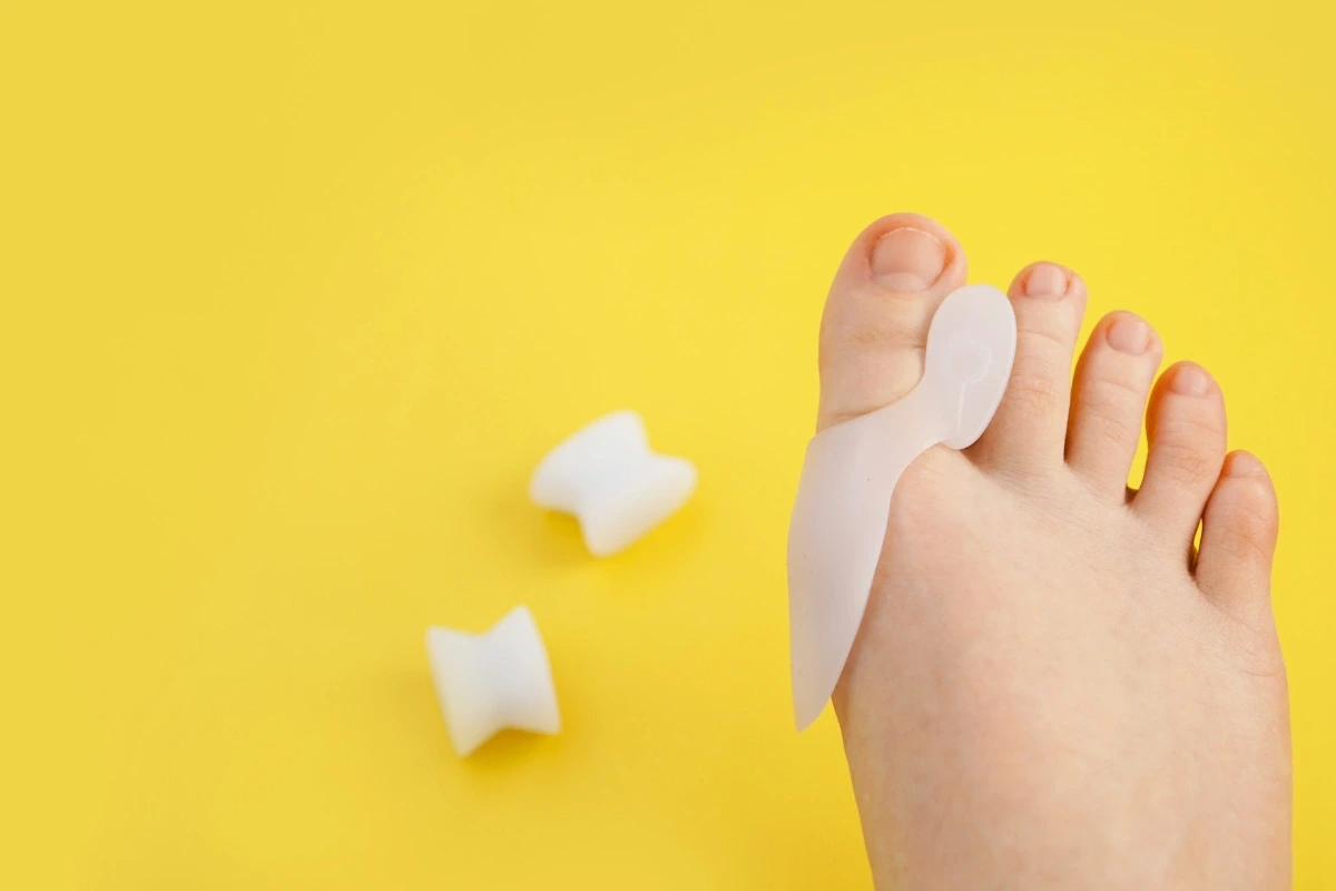 Chodidlo na žltom pozadí s nasadeným bielym silikónovým oddeľovačom prstov.